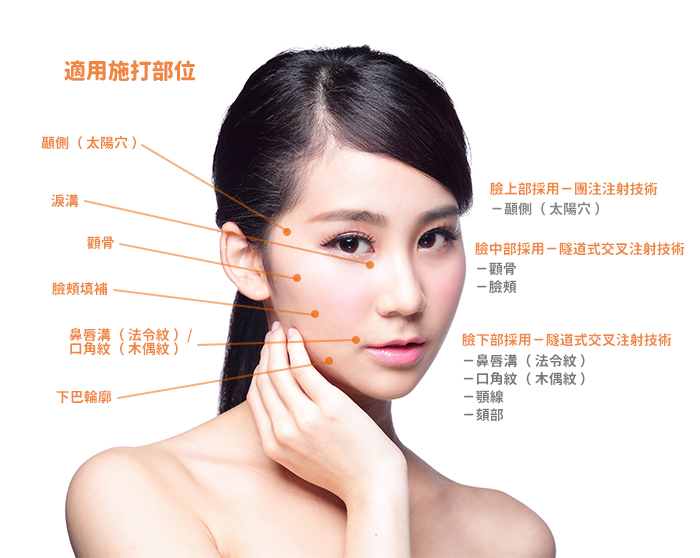 胶原新生的肌密  Sculptra?3D聚左旋乳酸（舒颜萃）详解