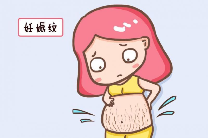 【产后修肚】讲解修腹手术（Tummy Tuck）