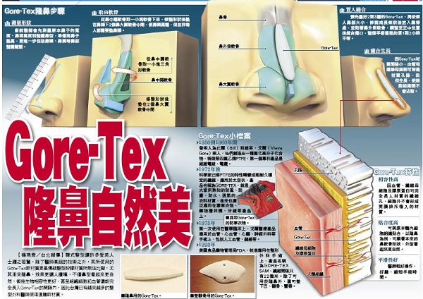 最自然的隆鼻材料是什么？Goretex和硅胶隆鼻的差别在哪里？