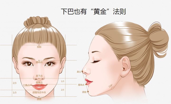 3D列印骨水泥下巴后悔可以取出吗？打过玻尿酸还可以做下巴手术吗？