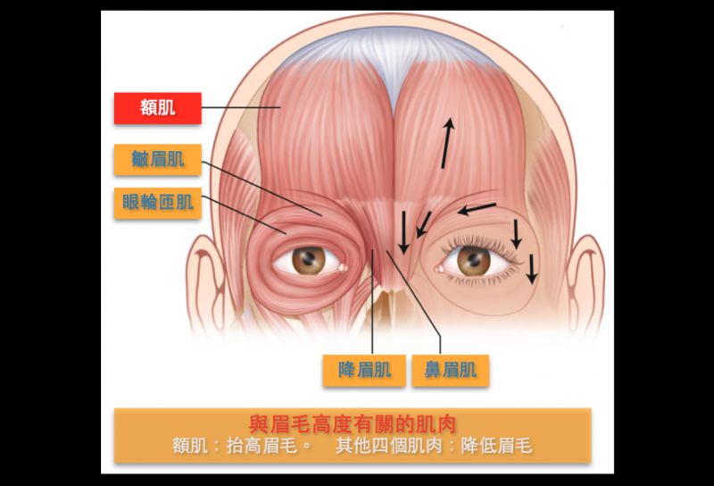 眉眼距离太短怎么办？提眉手术或是拉皮手术来解决