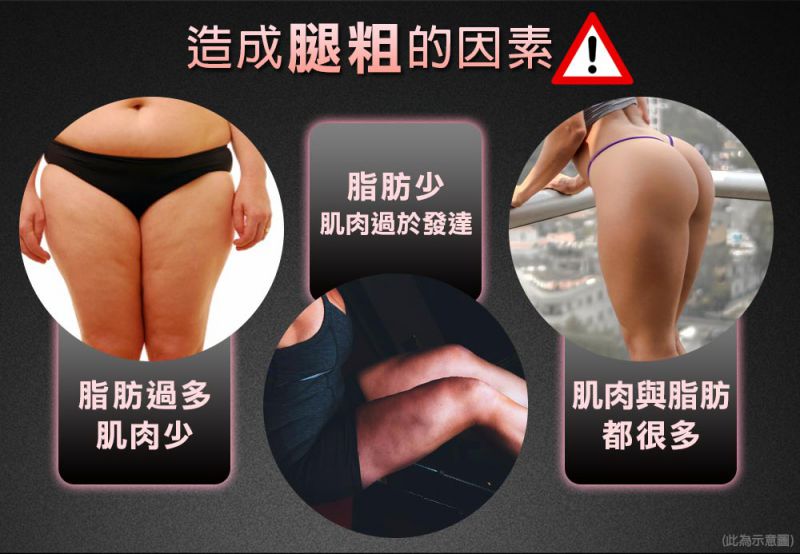 腿粗的原因有哪些？大腿臀部抽脂手术介绍