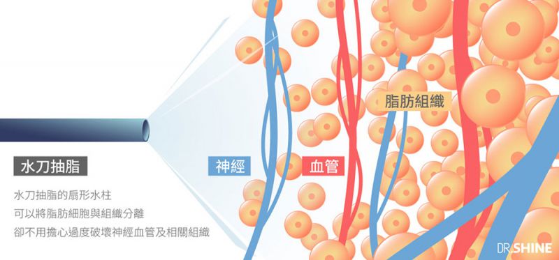 水刀抽脂和超音波抽脂分别有哪些优点？