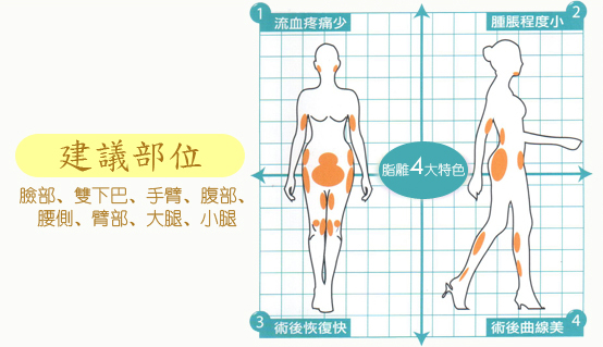 抽脂建议部位有哪些？什么是复合抽脂？水刀镭射震动抽脂谁效果最好？