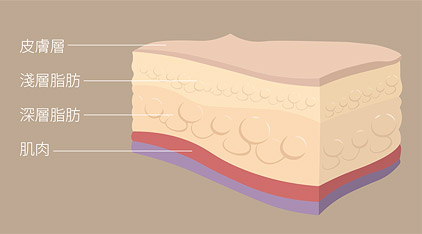 怎么区分浅层脂肪还是深层脂肪？深层脂肪和浅层脂肪可以一起抽脂吗？