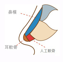 从鼻翼、鼻柱、鼻梁，打造专属自己的高挺美鼻