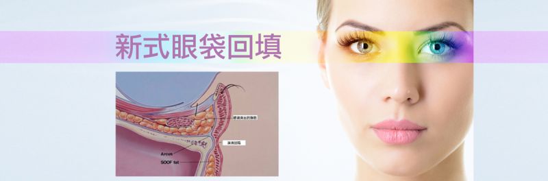 眼袋脂肪移位手术可同时改善黑眼圈、眼袋及泪沟吗