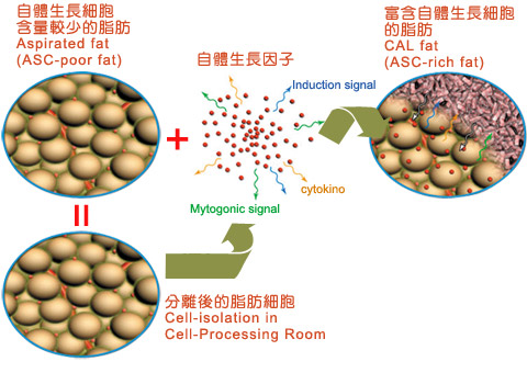 自体脂肪丰胸VS果冻矽胶隆乳VS传统脂肪丰胸谁效果更好？