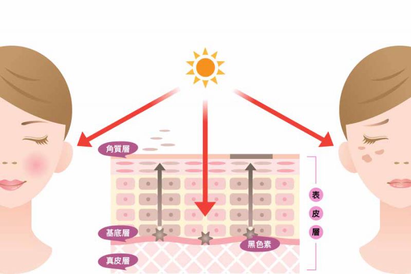 什么是皮秒？皮秒雷射会痛吗？皮秒雷射效果何时出现？