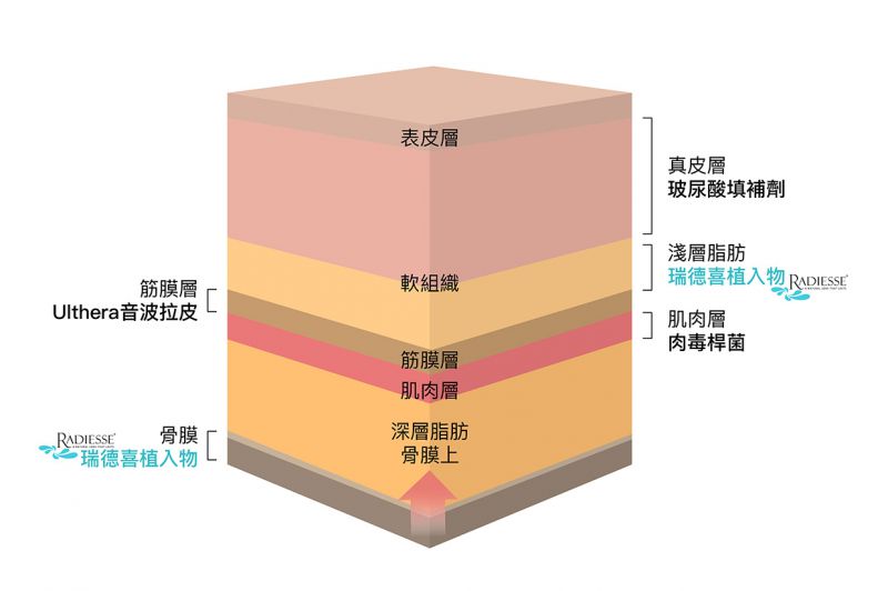 晶亮瓷里面含有骨粉是真的吗?瑞得喜与玻尿酸的差异?维持时间多久？