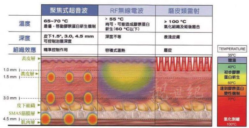 Ulthera极线音波拉皮的作用原理是什么？音波拉皮术前术后注意事项有哪些？