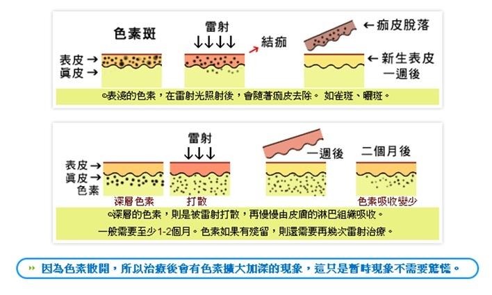 Neosys 粉红佳人净肤雷射效果怎么样？