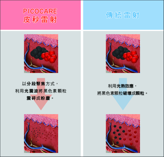 什么是皮秒雷射？PICOCARE【真?皮秒】优势原理功效有哪些？