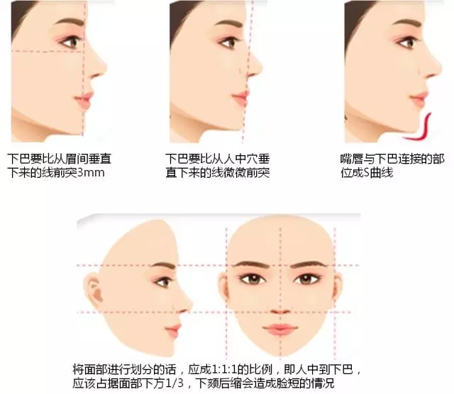 垫下巴（下巴成型）有哪几种方式？人工下巴硅胶软骨玻尿酸脂肪下巴