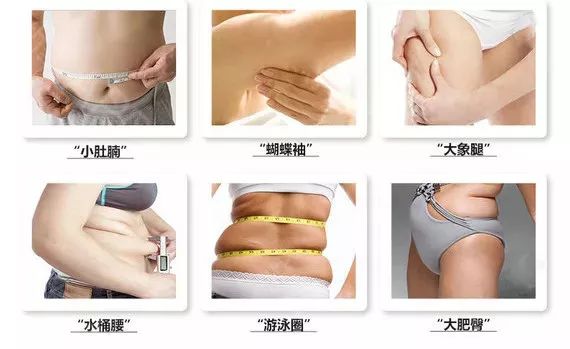 超音波抽脂(Ultra-Z Super Ultrasound Lipolysis)有哪些优点？