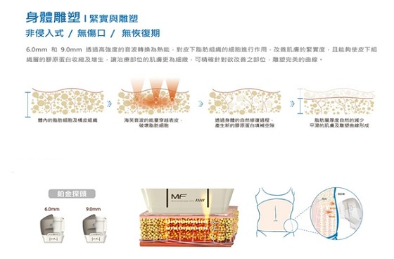 海芙音波跟极线音波该如何选择？ 音波拉提副作用恢复期？