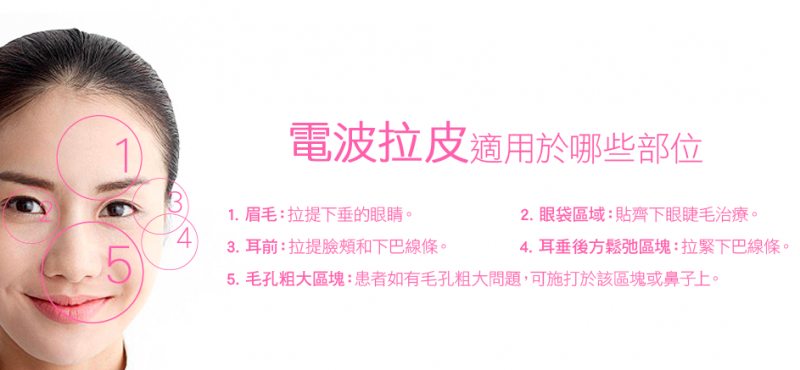 电波拉皮原理是什么？电波拉皮维持效果多久？电波拉皮注意事项