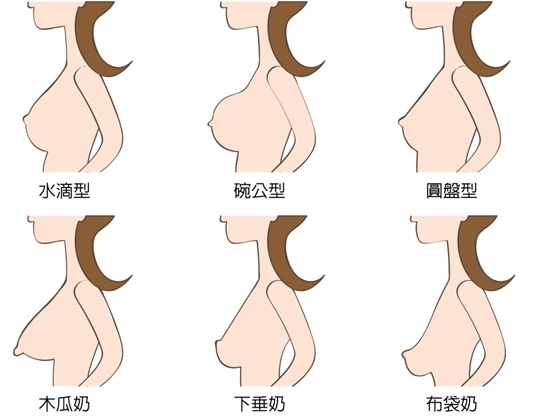 什么胸型适合自己呢？你适合做水滴果冻硅胶隆胸手术吗？