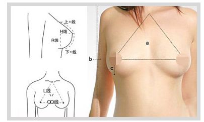 隆胸后会影响哺乳吗？隆胸后罹患乳癌的机率会增高吗？