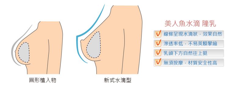 想增加三个罩杯只能做水滴假体隆胸吗？Mentor曼陀效果好吗？