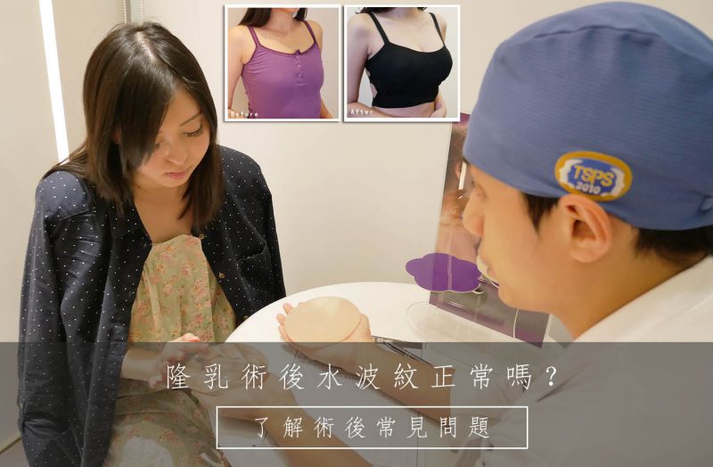 隆乳术后水波纹正常吗？了解隆胸术后常见问题