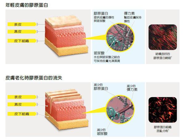 什么是洢莲丝Ellanse？洢莲丝Ellanse作用原理是什么？