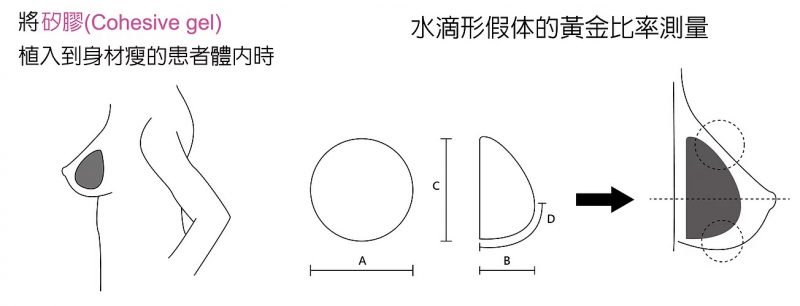 为什么要做缩乳手术?缩乳手术手术方式有哪些？