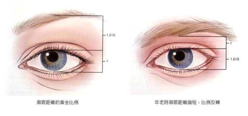 双眼皮术前注意事项及准备有哪些？