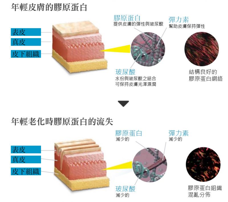 ELLANS?洢莲丝有几个剂型？维持时间效果一样吗？