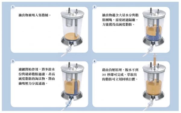 什么是水刀自体脂肪移植?水刀抽脂手术有哪些优点？