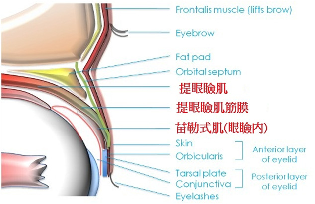 眼睑肌无力提眼睑肌可以改变眼神吗？