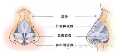 鼻子歪了是怎么回事？歪鼻必须要整形矫正吗？