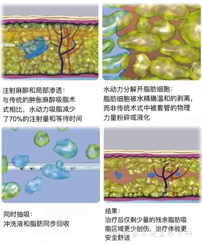 北医三院夏有辰：怎样减掉小肚子？