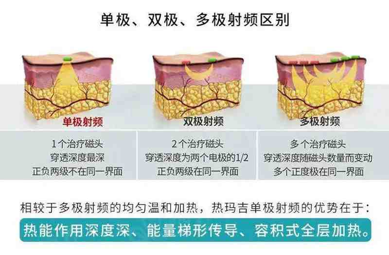 四十岁面部年轻化提升做哪个项目好？仪器还是面部拉皮？