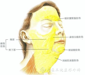 面部脂肪填充失败不自然能取出吗?