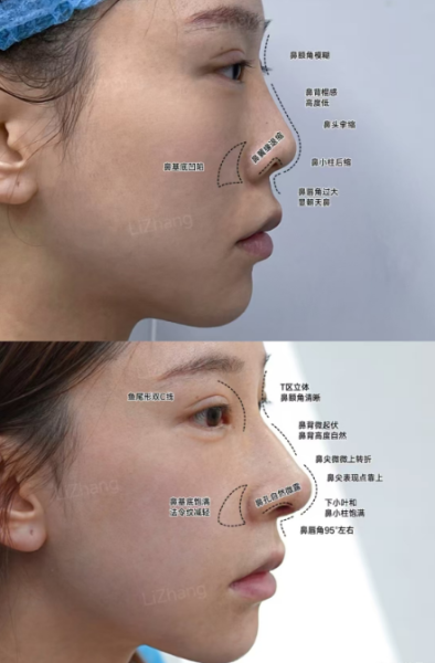 上海颜净医院李章、潘峰、李翔做鼻修复哪个医生好?