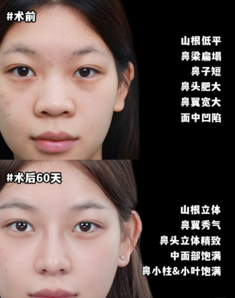 上海鼻修复医生预约排名:戴传昌、范荣杰、徐丽娟、王琳、李章、范锴、张勍枫