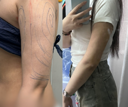 2026重庆吸脂哪个医生好?王棚、姜北、陶亮、王润芝、罗海军?