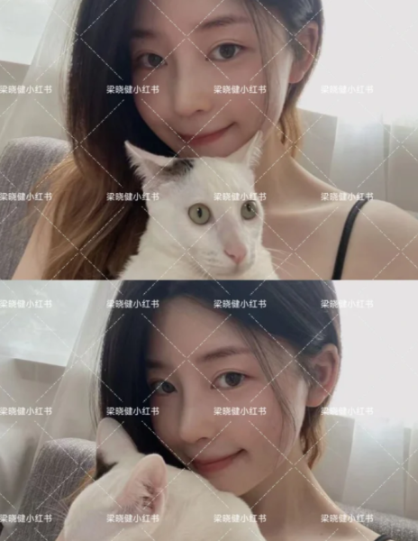 2026深圳隆鼻医生哪个做的最好?梁晓健、李信锋、文丰、郑文涛、张辉谁最好?