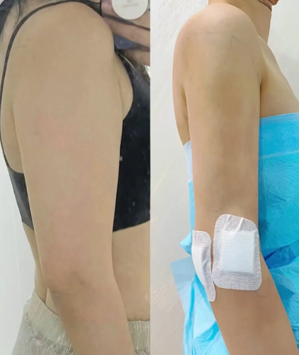 大连吸脂医生哪个好?康乐和郑妍丽做吸脂怎么样?