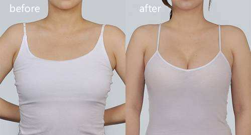 武汉做脂肪丰胸最好的医生是谁?孙家明丰胸怎么样? 武汉做脂肪丰胸最好的医生是谁?孙家明丰胸怎么样?