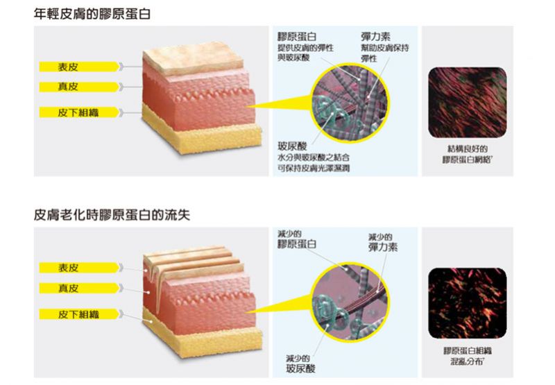 面部骨骼老化和脸部脂肪流失怎么办？