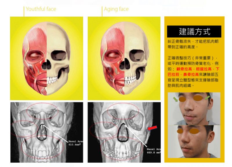 面部骨骼老化和脸部脂肪流失怎么办？