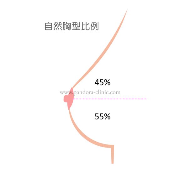 隆乳手术切口在哪里最好？隆胸手术切口优缺点及其胸型分析