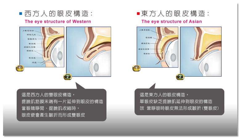 割式双眼皮缝式埋线双眼皮韩式订书针双眼皮全方位对比