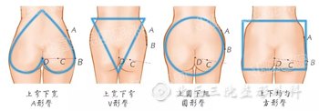 脂肪移植隆臀：如何拥有一颗完美翘臀？