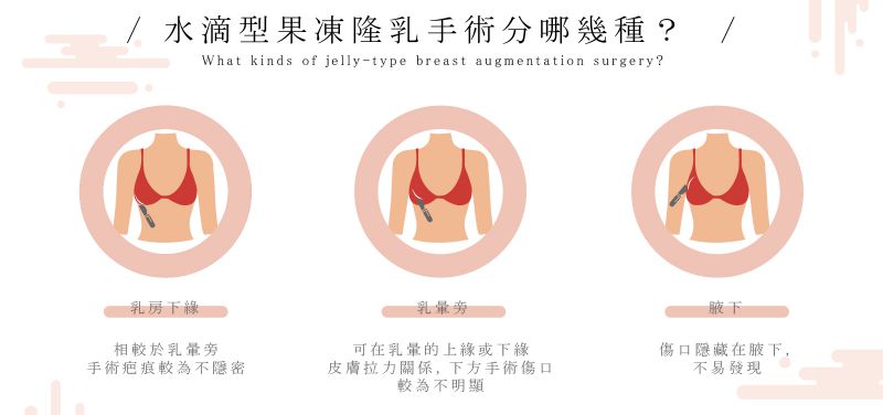 水滴形果冻矽胶分为哪几种？水滴形果冻矽胶优缺点分析