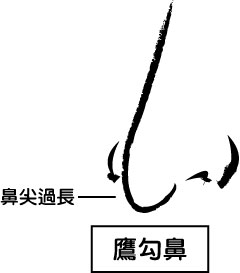 鼻梁整型手术有哪几种？鼻骨过宽、鼻骨变形弯曲马鞍鼻驼峰鼻鹰钩鼻