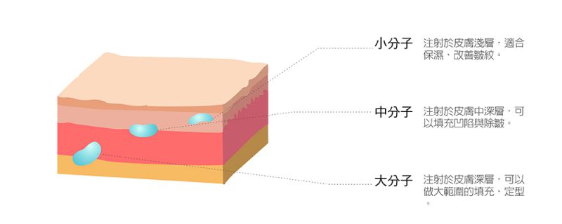 什么是玻尿酸？玻尿酸可用「分子大小」与「剂型」来做分类