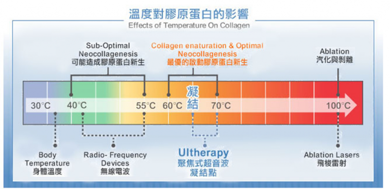 真正非侵入式拉皮：电波拉皮、音波拉皮原理简介